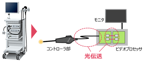 医療機器 内視鏡システムで用いられる光アクティブコネクタ（AOC）